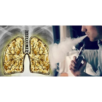 Vaping and popcorn lung